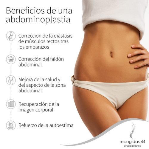 Abdominoplastia Granada